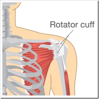 Shoulder Pain Sioux Falls SD Rotator Cuff Injury